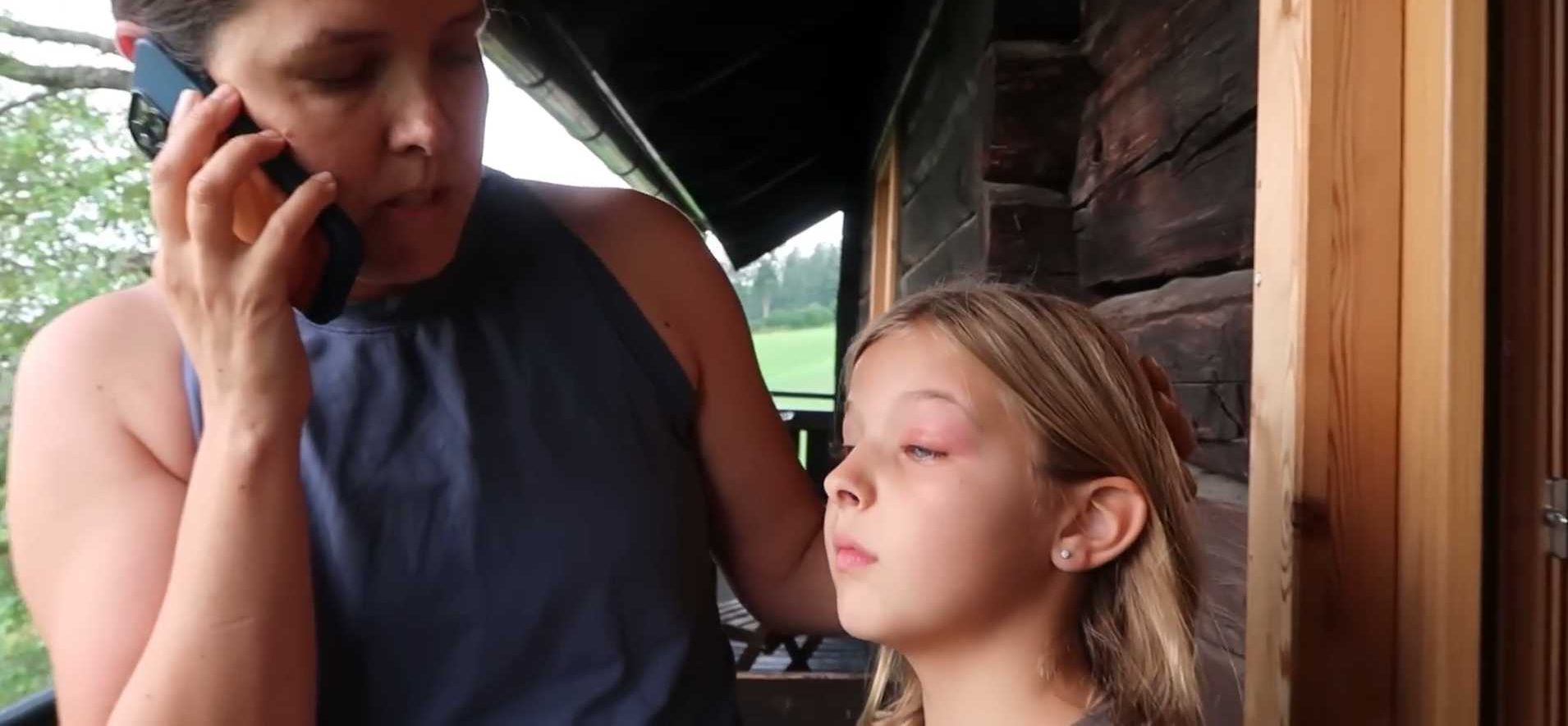 A Mysterious Swollen Eye in Austria